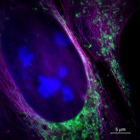 Diese Aufnahme des neuen Mikroskops zeigt eine lebende Knochenkrebszelle mit Zellkern (blau), Mitochondrien (grün) und Zytoskelett (magenta). Foto: Universität Bielefeld/ W. Hübner