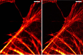 Die Mikroskopieaufnahmen zeigen Aktinfilamente in einer Endothelzelle aus einer Rinderpulmonalarterie unter strukturierter Beleuchtung. Im Bild rechts wurde Licht, das nicht aus dem Fokuspunkt stammt, rechnerisch entfernt und damit die Auflösung verbessert. Maßstab: 2 µm; Quelle: Leibniz-IPHT